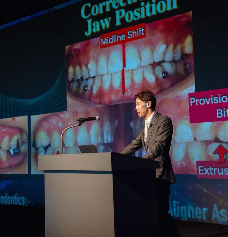 透明で目立ちにくいマウスピース インビザライン invisalign 気づかれにくいマウスピースでストレスフリーの歯列矯正
